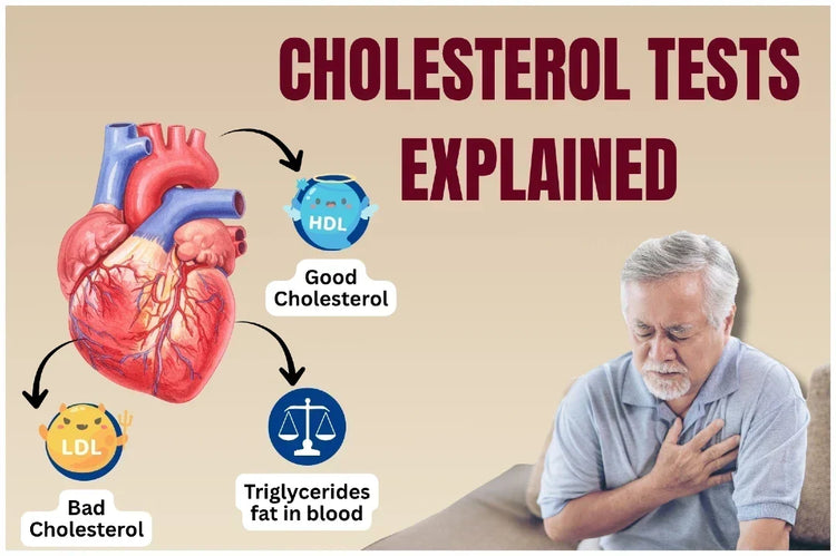 Cholesterol Tests Explained: Learn LDL, HDL, Triglycerides &amp; Ratios for Heart Health