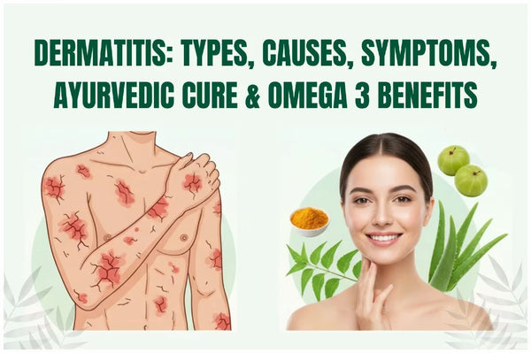 Dermatitis: Types, Causes, Symptoms, Ayurvedic Cure & Omega 3 Benefits