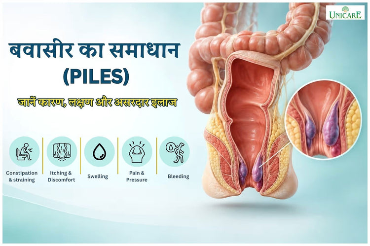 बवासीर का समाधान: जानें कारण, लक्षण और असरदार इलाज
