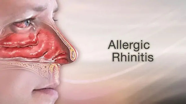 Beneficial in Sinusitis and allergic rhinitis