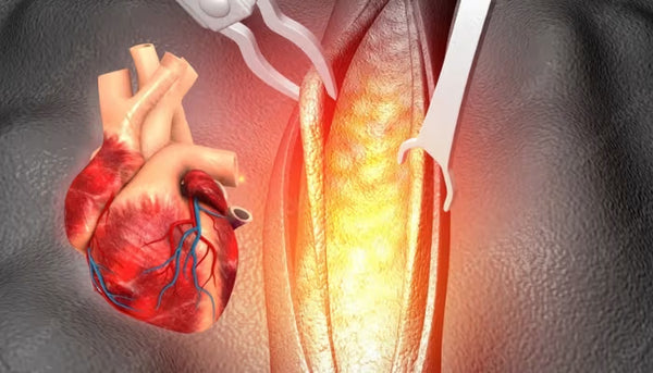 Supports recovery after angioplasty or bypass surgery