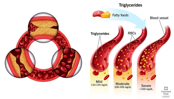 Reduces LDL and Triglycerides