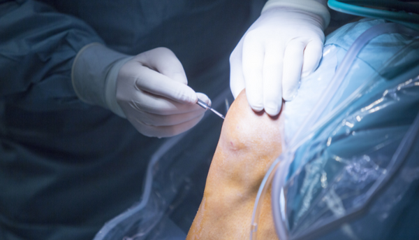 Repairs Cartilage & Strengthen Ligaments