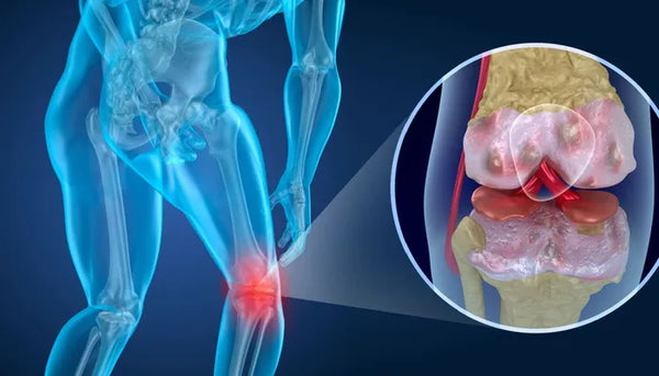Supports synovial fluid production for smooth joint function