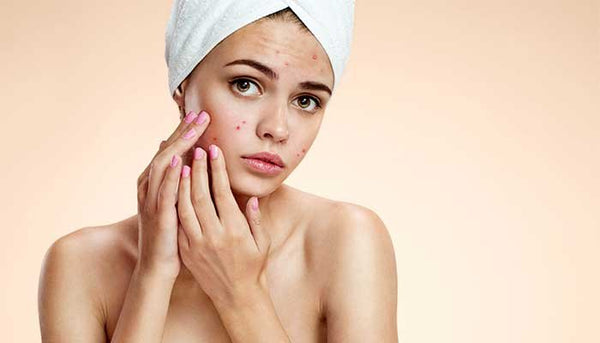 Promotes Glowing Skin