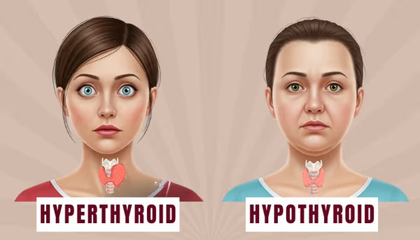 Helpful in hypothyroidism and hyperthyroidism.