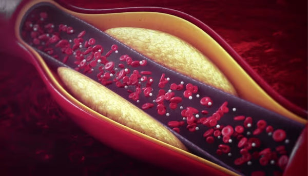 Supports healthy cholesterol balance.