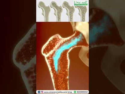 Joint Support: Supplement to Support Healthy Joint Function