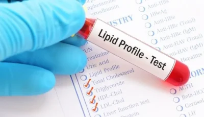 lipid profile test
